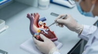 Aortic Dissection Causes